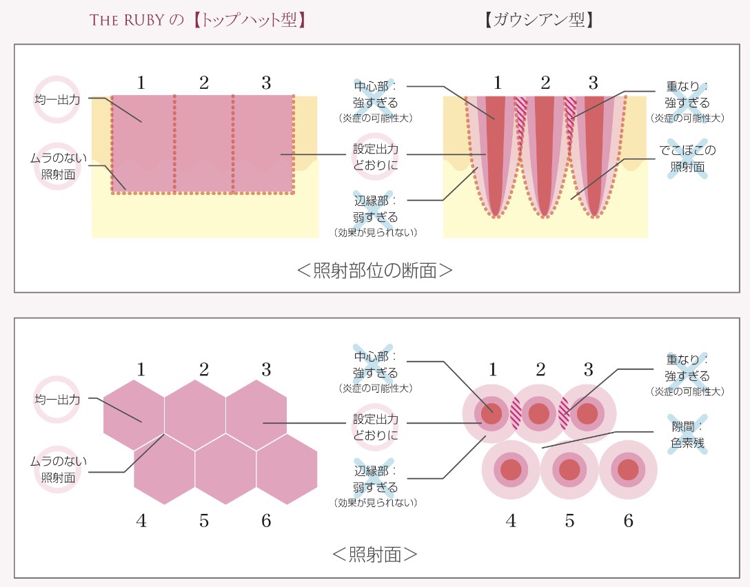 照射部位の断面