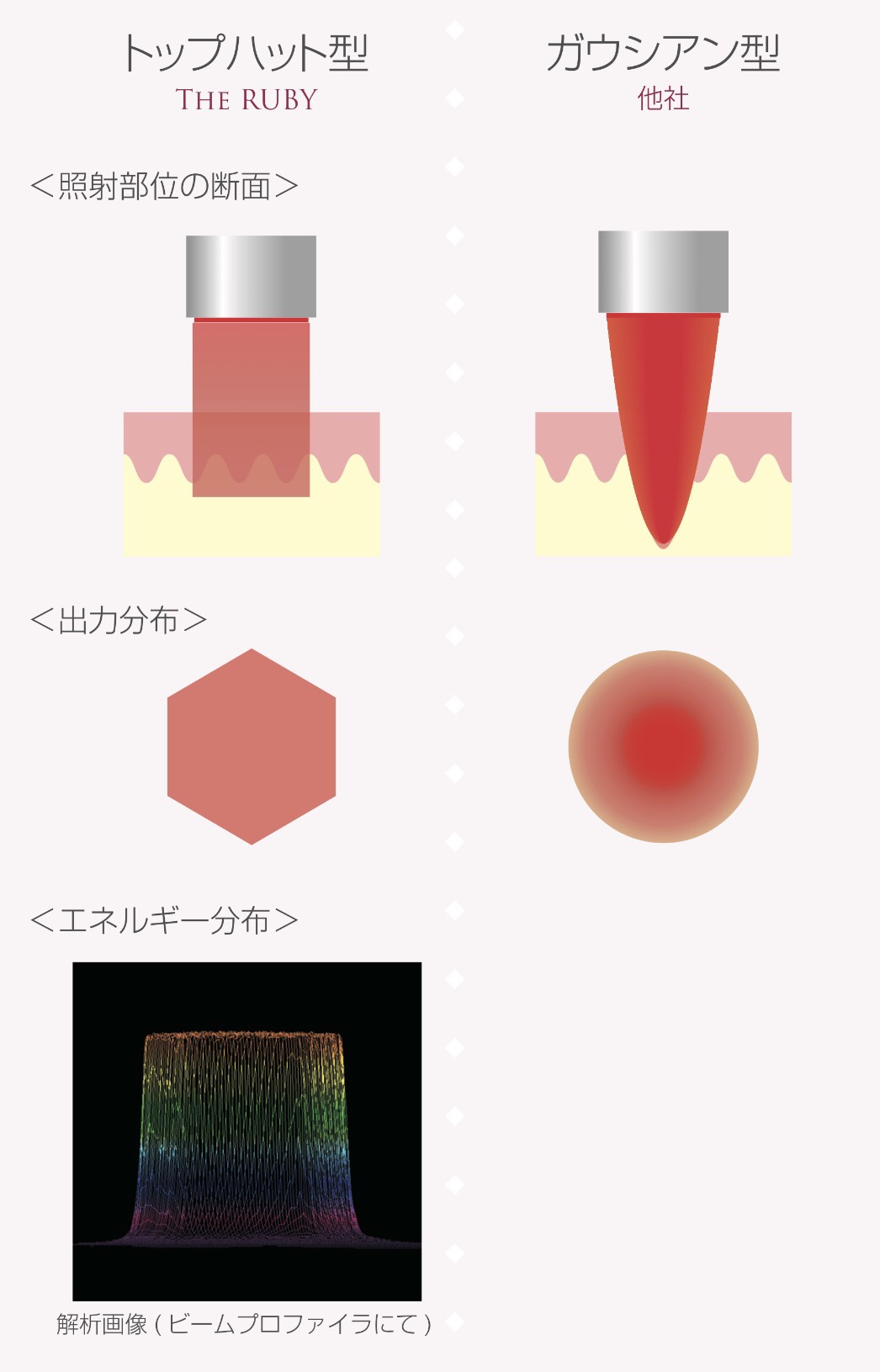 照射部位の断面